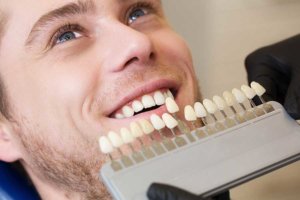 man preparing for teeth whitening orlando trusts