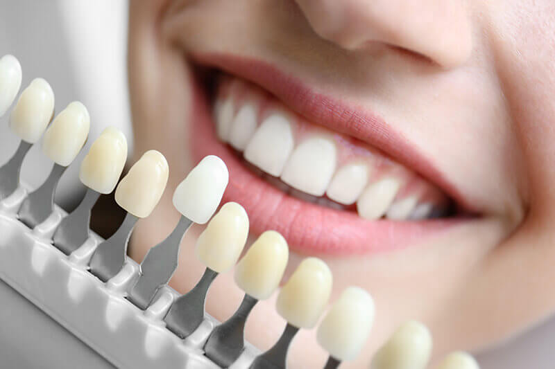 woman choosing tooth color benefits from cosmetic dentistry