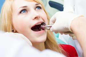 Young woman ready for wisdom teeth removal Orlando FL