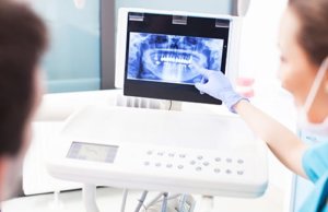Looking at digital xrays before root canal treatment Orlando trusts