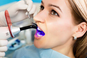 Woman in dentist chair experiencing composite fillings set with ultraviolet light